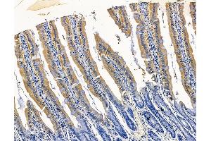 ABIN7096364 and ABIN7100427 at 1/100 staining rat colorectal tissue by IHC-P.