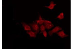 ABIN6274421 staining LOVO by IF/ICC. (TUSC5 antibody  (N-Term))