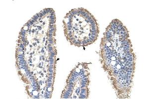 KRT2A antibody was used for immunohistochemistry at a concentration of 4-8 ug/ml to stain Epithelial cells of intestinal villus (arrows) in Human Intestine. (Keratin 2 antibody  (Middle Region))