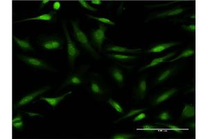 Immunofluorescence of monoclonal antibody to CALCOCO2 on HeLa cell. (CALCOCO2 antibody  (AA 347-446))
