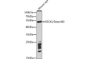 Western blot analysis of extracts of mouse eye, using SSC/SerpinB3 antibody (ABIN6131348, ABIN6147587, ABIN6147588 and ABIN6221070) at 1:1000 dilution.