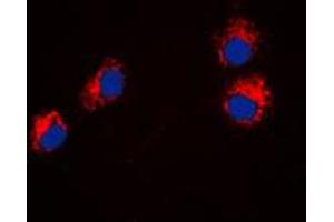 Immunofluorescent analysis of Semaphorin 4A staining in HeLa cells. (Sema4a antibody  (Center))