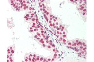 Human, Prostate: Formalin-Fixed Paraffin-Embedded (FFPE). (CTBP1 antibody  (C-Term))