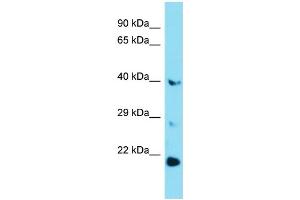 Western Blotting (WB) image for anti-Glucose 6-Phosphatase, Catalytic 3 (G6PC3) (Middle Region) antibody (ABIN2435708) (G6PC3 antibody  (Middle Region))
