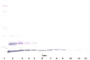 Image no. 1 for anti-Chemokine (C-C Motif) Ligand 15 (CCL15) antibody (Biotin) (ABIN465724) (CCL15 antibody  (Biotin))