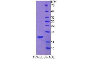 SDS-PAGE (SDS) image for Platelet-Derived Growth Factor C (PDGFC) (AA 235-345) protein (His tag) (ABIN6237393) (PDGFC Protein (AA 235-345) (His tag))