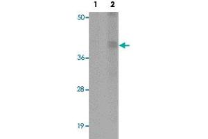 Western blot analysis of rat liver tissue with CALHM1 polyclonal antibody  at (Lane 1) 1 and (Lane 2) 2 ug/mL dilution.