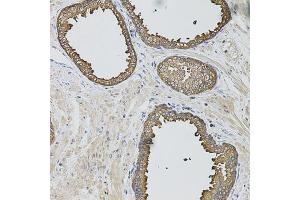 Immunohistochemistry of paraffin-embedded human prostate using CASP12 antibody. (Caspase 12 antibody)
