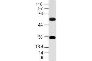 Image no. 1 for anti-Microphthalmia-Associated Transcription Factor (MITF) (AA 150-427) antibody (ABIN5027358)