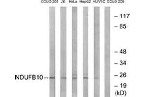 Western blot analysis of extracts from COLO/Jurkat/HeLa/HepG2/HuvEc cells, using NDUFB10 Antibody. (NDUFB10 antibody  (AA 63-112))