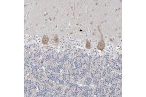 Immunohistochemical staining of human cerebellum with SDAD1 polyclonal antibody  shows moderate cytoplasmic and nucleolar positivity in Purkinje cells.