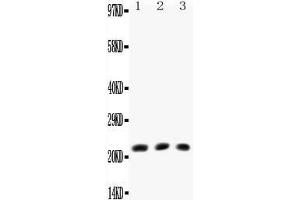 Anti-TNF beta antibody, All Western blottingAll lanes: Anti-TNF beta at 0. (LTA antibody  (N-Term))