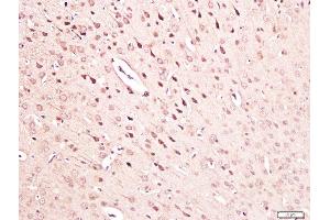 Paraformaldehyde-fixed, paraffin embedded mouse brain tissue, Antigen retrieval by boiling in sodium citrate buffer(pH6) for 15min, Block endogenous peroxidase by 3% hydrogen peroxide for 30 minutes, Blocking buffer (normal goat serum) at 37°C for 20min, Antibody incubation with Rabbit Anti-NGF Polyclonal Antibody, Unconjugated  at 1:300 overnight at 4°C, followed by a conjugated secondary and DAB staining (NGFB antibody  (AA 151-220))