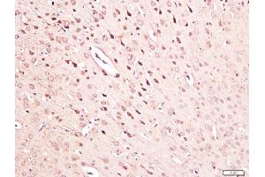 Paraformaldehyde-fixed, paraffin embedded mouse brain tissue, Antigen retrieval by boiling in sodium citrate buffer(pH6) for 15min, Block endogenous peroxidase by 3% hydrogen peroxide for 30 minutes, Blocking buffer (normal goat serum) at 37°C for 20min, Antibody incubation with Rabbit Anti-NGF Polyclonal Antibody, Unconjugated  at 1:300 overnight at 4°C, followed by a conjugated secondary and DAB staining (NGFB antibody  (AA 151-220))