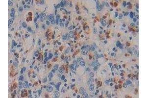Immunohistochemistry (IHC) image for anti-Interleukin 6 (IL6) (AA 27-212) antibody (ABIN7426637)