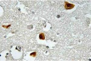 Immunohistochemistry (IHC) analyzes of p-IRS-1 antibody in paraffin-embedded human brain tissue. (IRS1 antibody  (pSer636))
