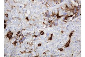 Image no. 1 for anti-ATP-Binding Cassette, Sub-Family B (MDR/TAP), Member 1 (ABCB1) (AA 995-1280) antibody (ABIN1491725) (ABCB1 antibody  (AA 995-1280))