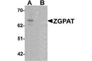 Western blot analysis of ZGPAT in SK-N-SH cell lysate with ZGPAT antibody at 1 ug/mL in (A) the absence and (B) the presence of blocking peptide. (ZGPAT antibody  (C-Term))