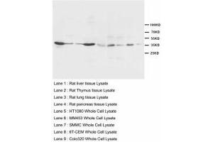 Image no. 1 for anti-Hematopoietically Expressed Homeobox (HHEX) (AA 24-39) antibody (ABIN1495424) (HHEX antibody  (AA 24-39))
