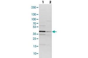 Western blot analysis of lane 1: NIH-3T3 cell lysate and lane 2: NBT-II cell lysate using TRIB2 polyclonal antibody . (TRIB2 antibody)