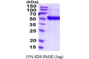 SDS-PAGE (SDS) image for Ectonucleoside Triphosphate diphosphohydrolase 3 (ENTPD3) (AA 44-485) protein (His tag) (ABIN6387811) (ENTPD3 Protein (AA 44-485) (His tag))