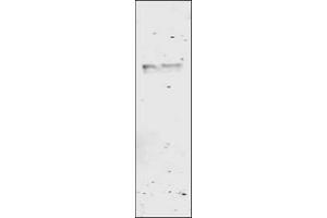Image no. 1 for anti-Glutathione S Transferase (GST) antibody (ABIN226631) (GST antibody)