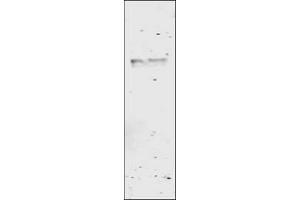 Image no. 1 for anti-Glutathione S Transferase (GST) antibody (ABIN226631) (GST antibody)