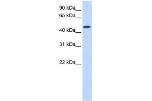 SULT2B1 antibody used at 1 ug/ml to detect target protein. (SULT2B1 antibody  (C-Term))