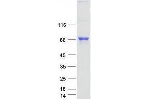 Validation with Western Blot (TDP1 Protein (Transcript Variant 2) (Myc-DYKDDDDK Tag))