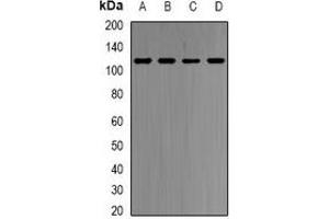Western blot analysis of HMGCR expression in HepG2 (A), Hela (B), mouse spleen (C), rat liver (D) whole cell lysates. (HMGCR antibody)