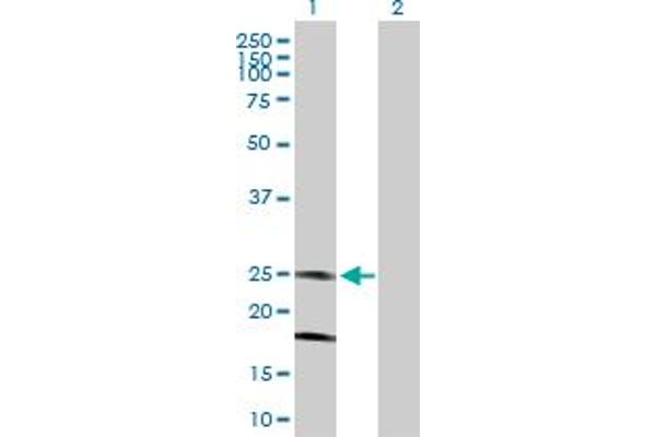 KCNMB4 anticorps  (AA 1-210)