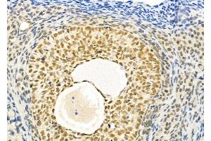 ABIN6257410 and ABIN6273736 at 1/100 staining Rat ovarian tissue by IHC-P. (PAX8 antibody  (N-Term))