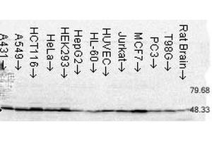 Western Blot analysis of Human Cell lysates showing detection of FKBP52 protein using Mouse Anti-FKBP52 Monoclonal Antibody, Clone Hi52C . (FKBP4 antibody  (PerCP))