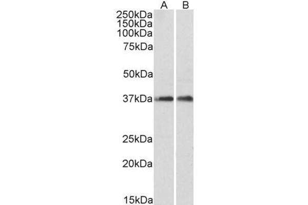 ARPC1A antibody  (C-Term)
