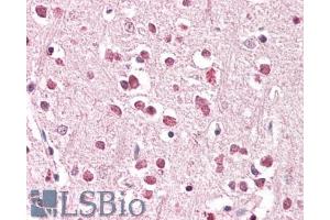 ABIN184588 (3. (XAB2 antibody  (C-Term))