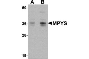 Western Blotting (WB) image for anti-Transmembrane Protein 173 (TMEM173) (C-Term) antibody (ABIN1030523) (STING/TMEM173 antibody  (C-Term))