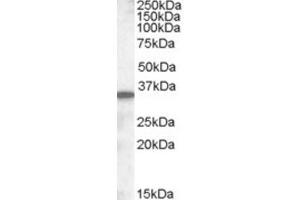 Western Blotting (WB) image for anti-Solute Carrier Family 10 (Sodium/bile Acid Cotransporter Family), Member 2 (SLC10A2) (C-Term) antibody (ABIN2466742) (SLC10A2 antibody  (C-Term))