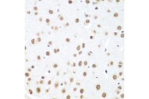 Immunohistochemistry of paraffin-embedded mouse brain using DDX39B antibody.