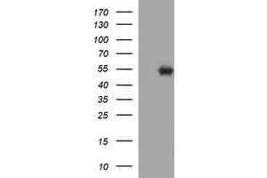 Image no. 1 for anti-Tubulin, beta 1 (TUBB1) antibody (ABIN1501570)