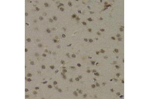 Immunohistochemistry of paraffin-embedded mouse brain using PAWR Antibody (ABIN5971565) at dilution of 1/200 (40x lens). (PAWR antibody)