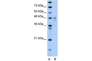 PDK4 antibody used at 1 ug/ml to detect target protein. (PDK4 antibody  (N-Term))