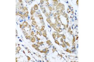 Immunohistochemistry of paraffin-embedded human stomach using ANTXR2 antibody (ABIN5975032) at dilution of 1/100 (40x lens). (ANTXR2 antibody)