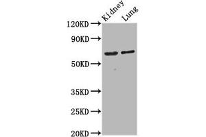 Western Blot Positive WB detected in: Rat kidney tissue, Mouse lung tissue All lanes: SRRM4 antibody at 4. (SRRM4 antibody  (AA 400-479))