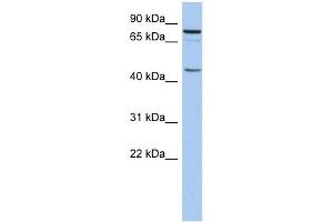 RNF169 antibody used at 1 ug/ml to detect target protein. (RNF169 antibody  (N-Term))