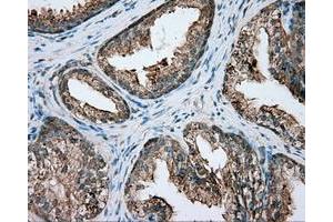 Immunohistochemical staining of paraffin-embedded pancreas tissue using anti-PIM2 mouse monoclonal antibody. (PIM2 antibody)