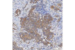 IHC analysis of Mitochondrial Dicarboxylate Carrier/SLC25A10 using anti-Mitochondrial Dicarboxylate Carrier/SLC25A10 antibody (ABIN7601497).