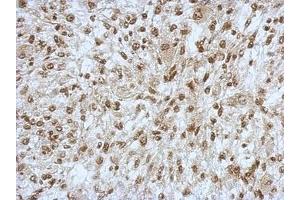 Image no. 2 for anti-Sin3A-Associated Protein, 130kDa (SAP130) (N-Term) antibody (ABIN1494118) (SAP130 antibody  (N-Term))