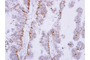 Immunohistochemistry (IHC) image for anti-Protein-tyrosine Phosphatase 1C (PTPN6) antibody (ABIN2855500)