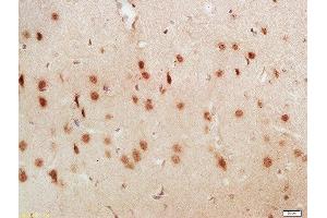 Formalin-fixed and paraffin embedded rat brain labeled with Anti-LUC7L3 Polyclonal Antibody, Unconjugated  at 1:200 followed by conjugation to the secondary antibody and DAB staining
