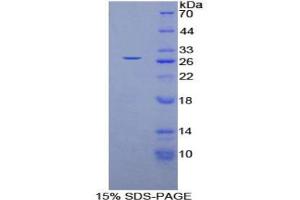 SDS-PAGE analysis of Human GSTm4 Protein.
